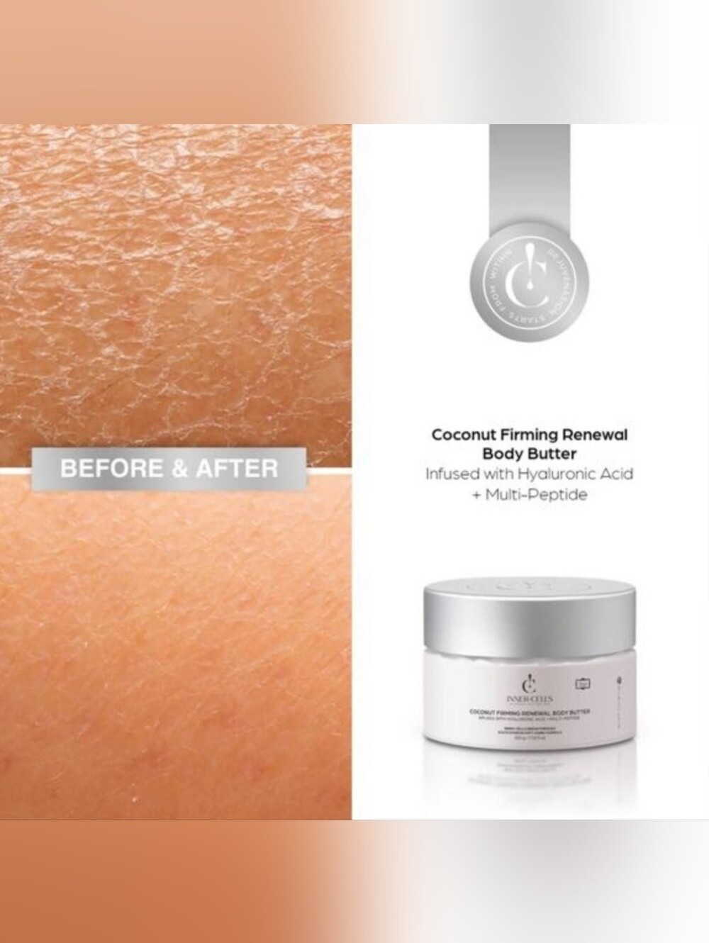 Inner Cells Coconut Firming Renewal Body Butter - Picture 2 of 5